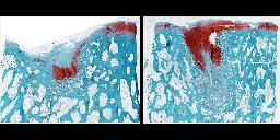 Neues Biomaterial lässt Knorpel nachwachsen