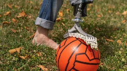 Motorlose Fußprothese ahmt menschlichen Fuß nach